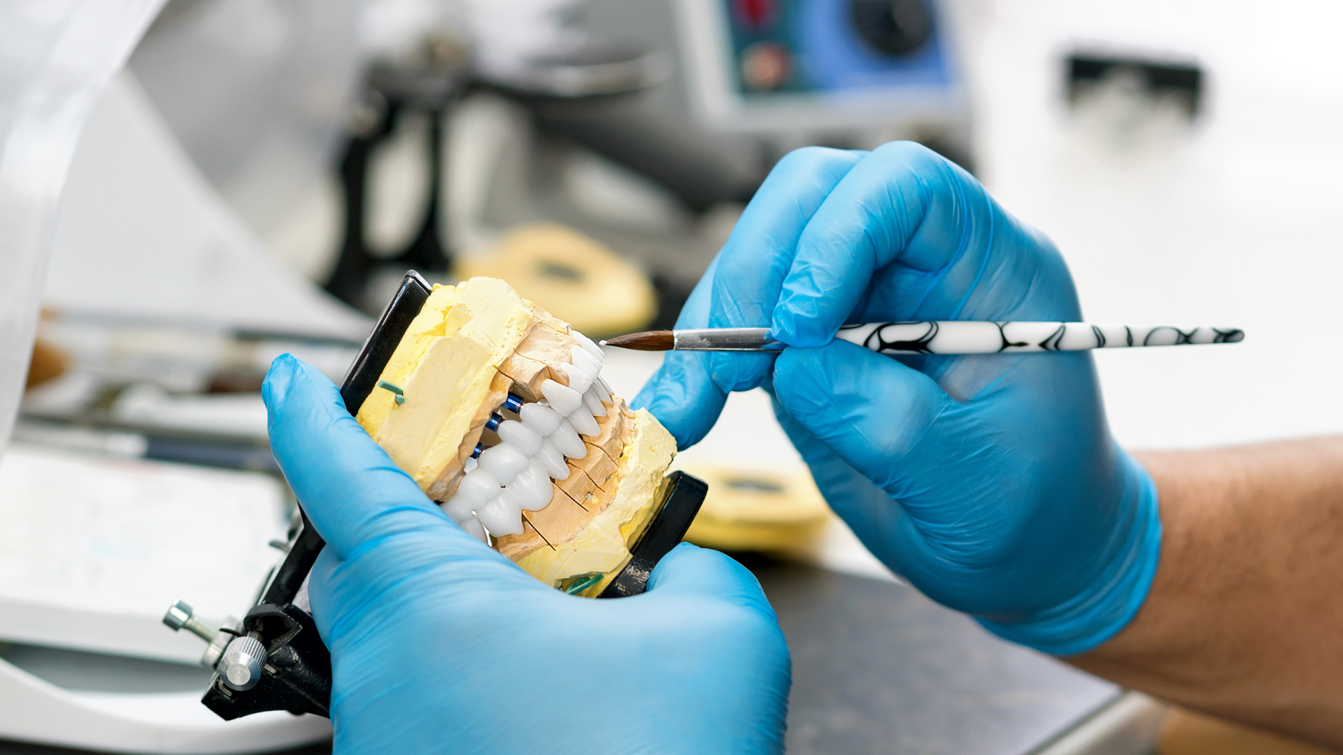Should You See a Prosthodontist? Unveiling the Dental Restoration Experts